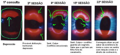Cliente E Cliente E